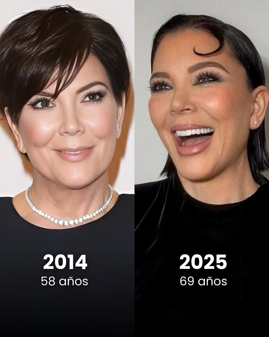 ✨¿Cómo es posible que Kris Jenner luzca más radiante a los 69 años que en sus 50_😱💫__Al comparar sus fotos desde 2014 hasta 2025_ es evidente q_2